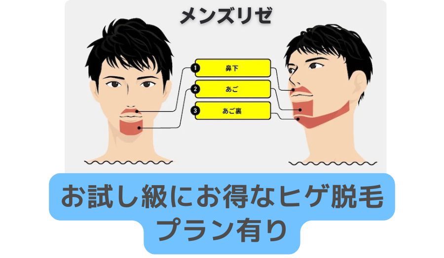 メンズリゼお試し級にお得なヒゲ脱毛プラン