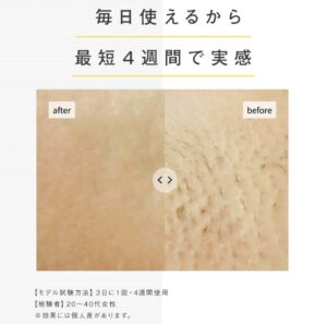 JOVS脱毛器は毎日使っても大丈夫？JOVS Doraの最適な使用頻度を解説 | ヒゲペディア