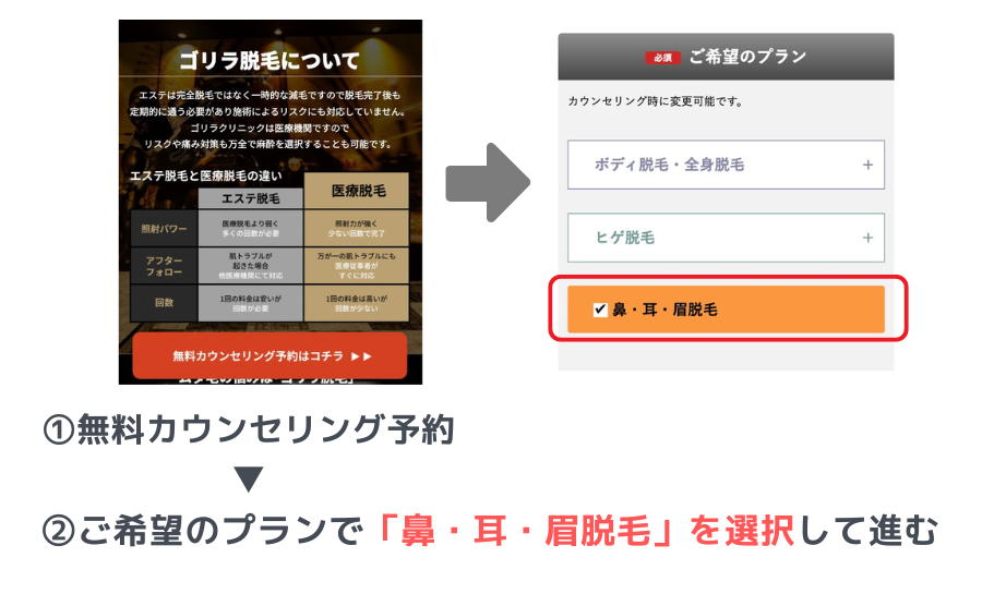 鼻・耳・眉脱毛の予約方法 ゴリラクリニック
