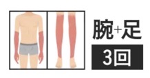 メンズエミナルの腕・足3回脱毛