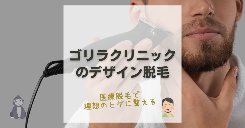 ゴリラクリニックのヒゲデザイン脱毛で理想のスタイルを実現