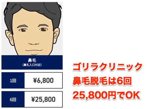 ゴリラクリニックの鼻毛脱毛料金