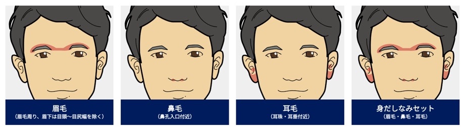 ゴリラクリニック身だしなみ脱毛
