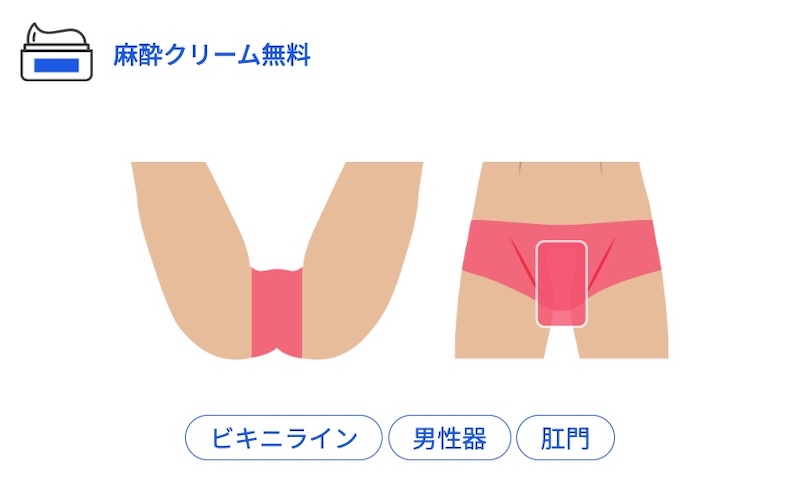 レジーナクリニックVIO脱毛、麻酔クリーム無料